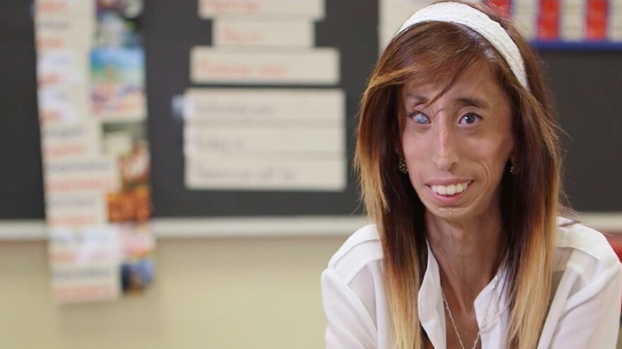 Lizzie Velasquez